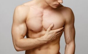 Leia mais sobre o artigo GINECOMASTIA