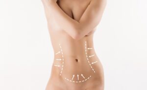 Leia mais sobre o artigo LIPOESCULTURA O CORPO DOS SEUS SONHOS