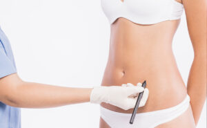 Leia mais sobre o artigo CUIDADOS PÓS BARIÁTRICA