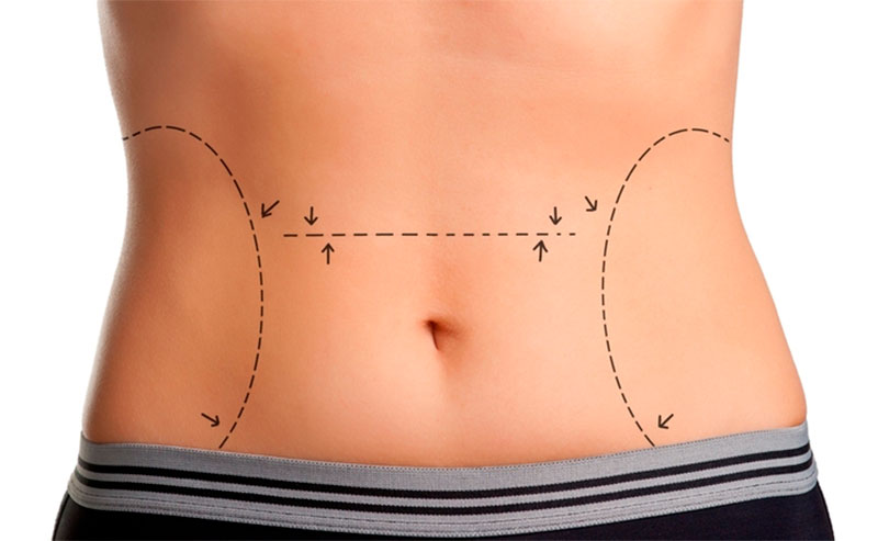 No momento, você está visualizando Cuidados essenciais após toda cirurgia plástica