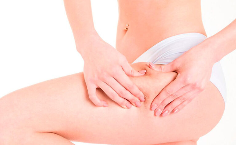 Leia mais sobre o artigo Tratamentos intensivos para melhorar a celulite de forma eficaz