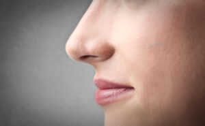 Leia mais sobre o artigo Qual a idade mínima para fazer uma cirurgia de Rinoplastia?